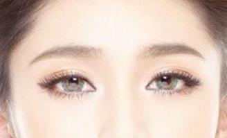 石家莊美聯(lián)臣雙眼皮整形靠譜嗎？有哪些優(yōu)秀醫(yī)生？有什么成功案例供參考？