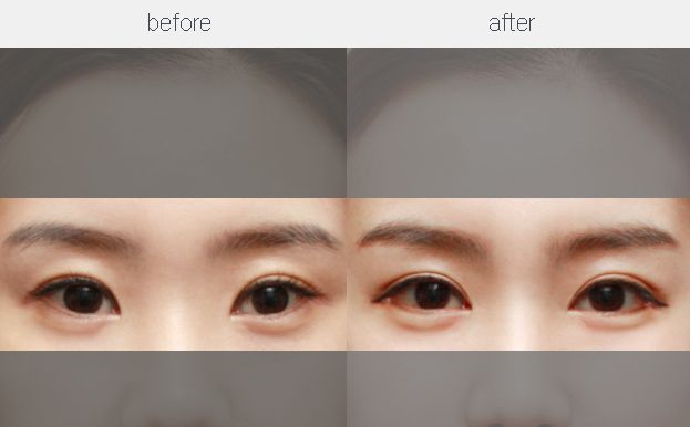 【特約】重慶鼻整形手術(shù)修復(fù)醫(yī)生五強名單揭曉，專家推薦！