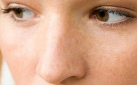 成都晶膚董薇薇解密：技術實力直擊美肌術后評價