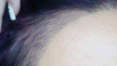 杭州隆胸醫(yī)院，解鎖完美身材，助你歡度自信人生！