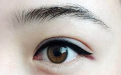 南寧醫(yī)科大雙眼皮整形費用及技術綜述！名單與收費指南分享