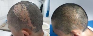 上海治療斑點(diǎn)好的醫(yī)院有哪些？伊萊美、仁愛、薇琳等都備受認(rèn)可！