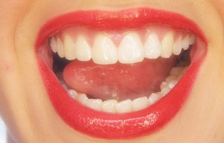 深圳藝星整形醫(yī)院技術(shù)如何？醫(yī)生靠譜嗎？整形效果好不好？