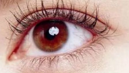 經(jīng)驗(yàn)豐富的專業(yè)修復(fù)師鄭永生，展示雙眼皮修復(fù)案例