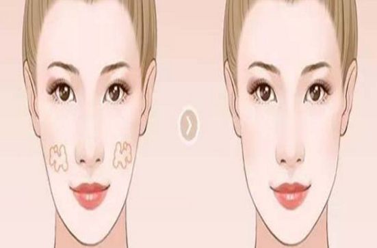 鄭州專業(yè)隆鼻醫(yī)生推薦！這幾位技術(shù)嫻熟，信譽(yù)口碑不容錯(cuò)過