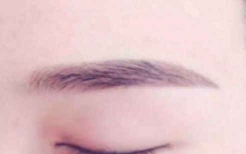 大連有哪家醫(yī)院是做鼻子手術(shù)的佼佼者？強力推薦，值得分享！