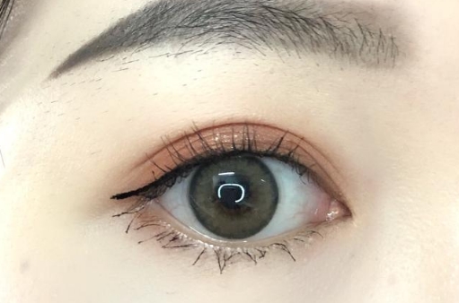 葉秀娣吸脂效果如何？值得一試嗎？