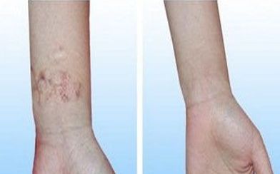 2023年武漢脫發(fā)治療獨家名單曝光！醫(yī)術(shù)嫻熟，聲譽遙遙領(lǐng)先！