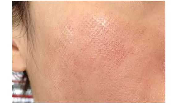 貴陽豐鼻醫(yī)生推薦TOP7專家候選已鎖定，屆時欽點(diǎn)！