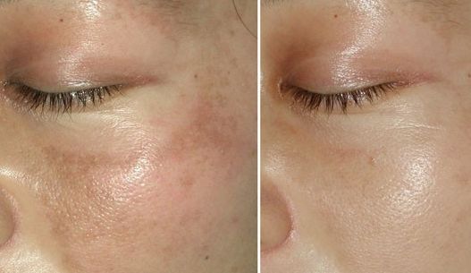 南充優(yōu)質眼部整容醫(yī)生推薦，專家級名醫(yī)榜單發(fā)布