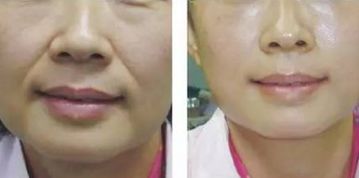 青島鼻修復(fù)：頂級專家實力享譽！唇齒相依的實力推薦