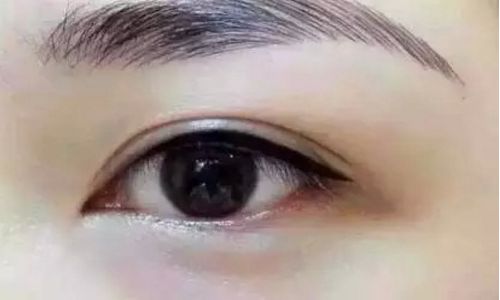 懿恩醫(yī)療美容的吸脂案例最新發(fā)布，效果驚艷，你不容錯過！