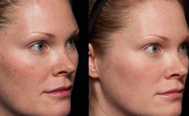 2023年南京磨骨醫(yī)生排行榜！這5位專家大咖讓您眼前一亮！