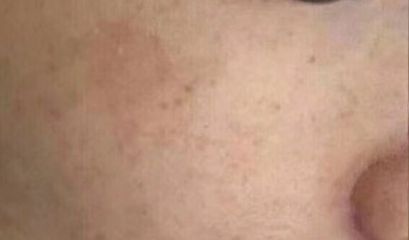 南京優(yōu)質(zhì)雙眼皮修復(fù)醫(yī)生推薦，5位專家點(diǎn)評述評