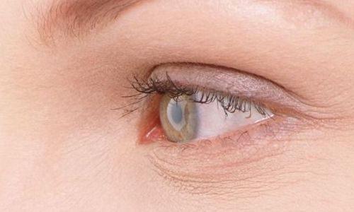 航空院眼袋手術(shù)效果如何？最新案例分享