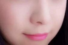 杭州哪家醫(yī)院割雙眼皮效果出眾？推薦藝星、時(shí)光、格萊美等受歡迎醫(yī)療機(jī)構(gòu)