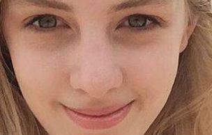 三亞心夢醫(yī)學(xué)院醫(yī)師劉濤揭秘受歡迎的吸脂手術(shù)案例分享