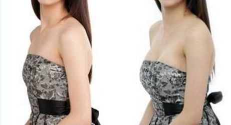 全國(guó)哪里可以找到專業(yè)的拉皮手術(shù)醫(yī)生？2023比較好幫手來(lái)了！