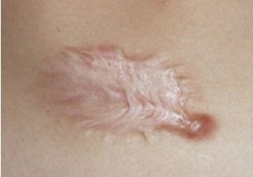 重慶上佳雙眼皮醫(yī)院推薦，口碑高的有這5家！