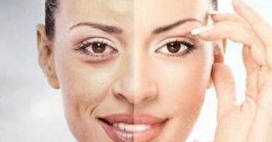 成都賈德淵醫(yī)生的眼睛技術(shù)有何不同？80天變化詳解