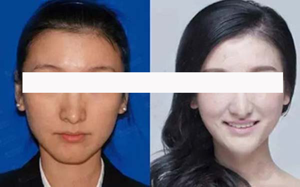 寧波藝星整形和珈禾整形，哪家更具實力？醫(yī)生口碑、項目擅長和地址公布等方面的對比如何？