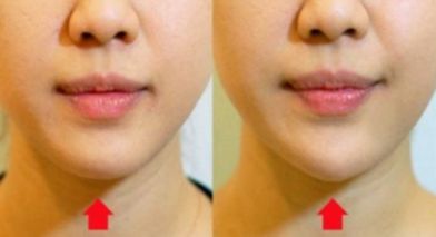 重磅發(fā)布！南京五家面部吸脂醫(yī)院排行盛況揭曉！