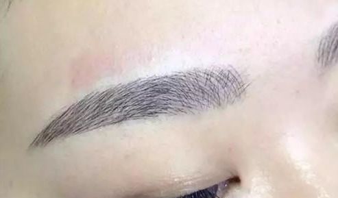 昆明祛斑哪家醫(yī)院更受歡迎？大眾口碑告訴你答案！