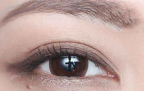 林琳雙眼皮修復(fù)失敗案例分享，術(shù)后視野恢復(fù)亮眼！