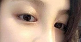 如何選擇合適的醫(yī)生，讓你的身材變得完美無(wú)暇