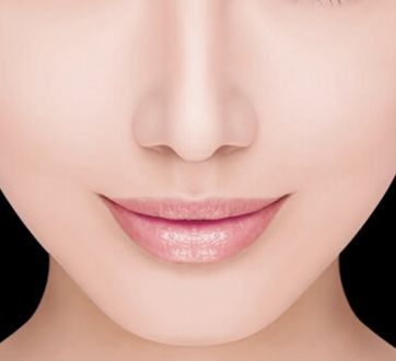 哈醫(yī)大四院李巍主治醫(yī)生鼻整形手術(shù)！80天重塑完美鼻型全記錄！