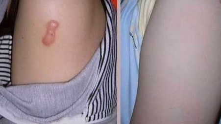 上海知名醫(yī)生手術CG費用曝光，驚人低價吸引眾多患者！