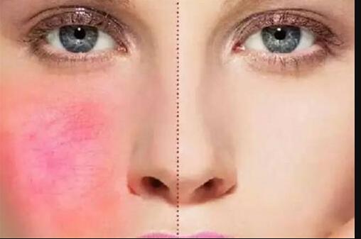 榆林雙眼皮修復(fù)誰(shuí)的技術(shù)更值得信賴？