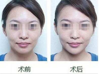 沈陽市的專業(yè)雙眼皮整形醫(yī)院哪家好，排名前三值得信賴