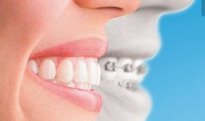 賀煥煥做雙眼皮修美，醫(yī)生簡(jiǎn)介及2023價(jià)格明細(xì)公布！