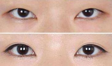 矚目！莊洪興醫(yī)生的綜合評價和形象考察