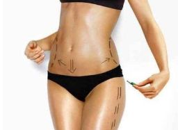 齊魯醫(yī)院大腿抽脂案例分享：專家解析、費用說明、效果好嗎