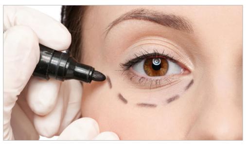 濟(jì)南中心醫(yī)院整形科靠譜嗎？有哪些雙眼皮價(jià)格與案例值得一看？