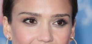 長沙張姣姣醫(yī)生教你如何實現(xiàn)完美雙眼皮技術(shù)