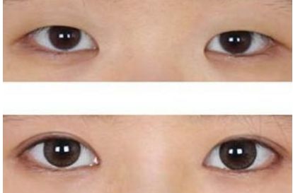 哪家整形醫(yī)院是濟(jì)南市最受信賴的？三大醫(yī)療機(jī)構(gòu)曝光！