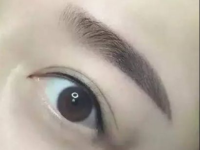 護眼實踐：林琦東如何改善視力？真實案例揭示眼部整形費用