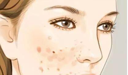 上海的醫(yī)院中，哪家醫(yī)院在祛痘方面比較有名？藝星和時(shí)光醫(yī)院的祛痘價(jià)格目錄和效果如何呢？