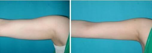 廈門美麗薇醫(yī)療美容診所值得信賴嗎？專業(yè)醫(yī)美整形機構(gòu)嗎？