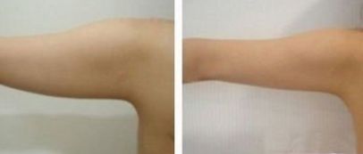 西部戰(zhàn)區(qū)一流眼科專家介紹，技術(shù)評(píng)估及收費(fèi)參考