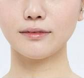 國內(nèi)哪些醫(yī)院在頜面整形方面做得更好？優(yōu)質(zhì)正頜手術(shù)醫(yī)院推薦