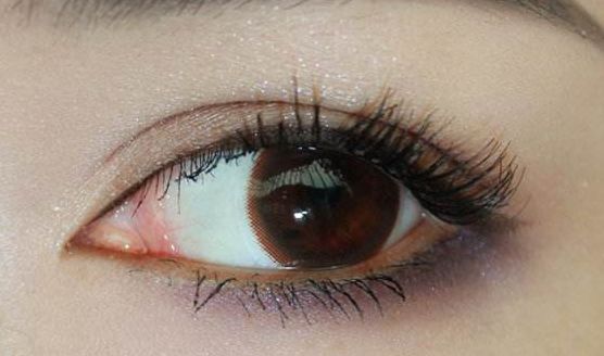 為何陳付國(guó)做隆鼻會(huì)價(jià)值不菲？一位真實(shí)案例分享揭示原因