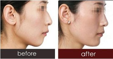 深圳哪些醫(yī)生已獲得2023年喬雅登認(rèn)證？全新名單發(fā)布！