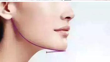 長(zhǎng)沙愛思特整形醫(yī)院：正規(guī)可信賴，服務(wù)周到！