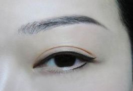 深圳著名眼袋整形專家?guī)湍獯?，鵬程醫(yī)院是否值得選擇？