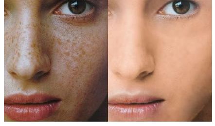 成都維度整形醫(yī)生技術(shù)點(diǎn)贊！實(shí)例曝光，周維做鼻子效果驚艷！