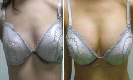 成都雙眼皮整形醫(yī)院哪家好？專家推薦的排行榜前十強